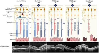 Gene-agnostic therapeutic approaches for inherited retinal degenerations